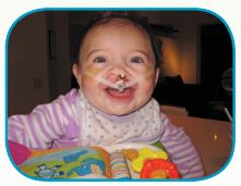 many newborns with a cleft lip or palate, reconstructive treatment can begin soon after birth with use of a pre-surgical device known as a nasoalveolar molding (NAM) appliance- image of baby during surgery.